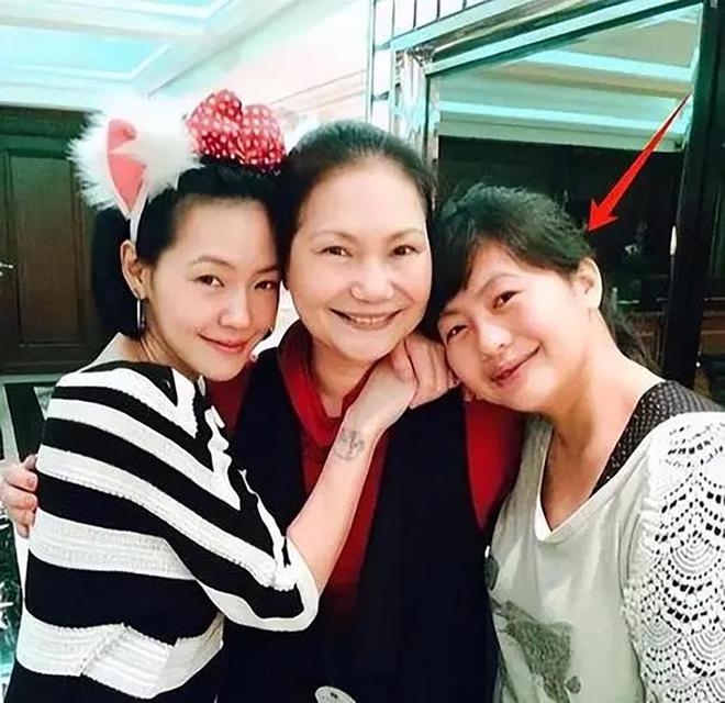 小S婆婆澳门旅游眼含泪光心情悲痛眼角淤青疑似受伤！(图1)