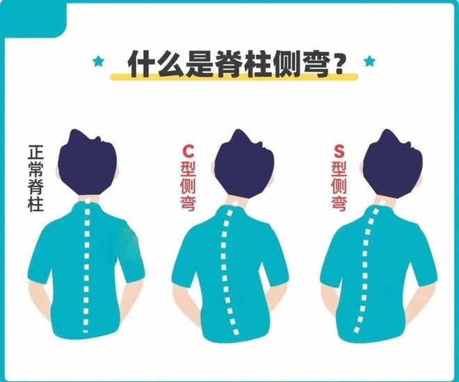 【明仁与健康】中医整脊让青少年脊柱不走“弯”路(图1)